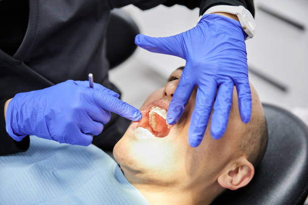 Best Walk-In Emergency Dentist in Belmont, CA